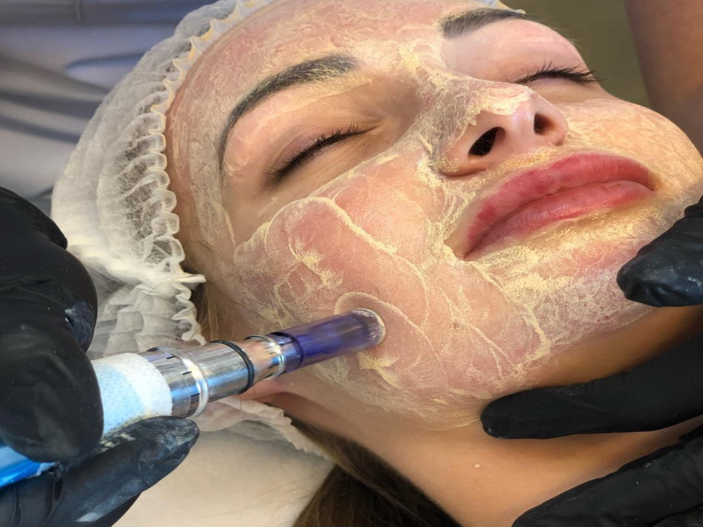 Obalamy mity dotyczące zabiegów BB Glow Skin