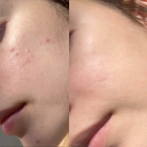 Perfect Image - Lactic 10% Brightening Gel Peel (LEVEL R)