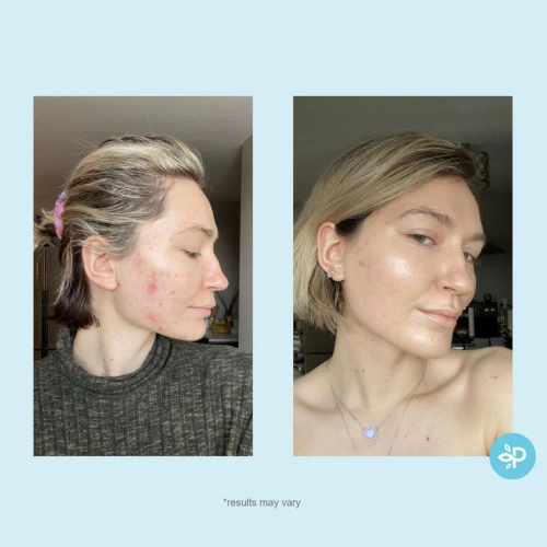 Perfect Image - Hydro-Glo 10%  Peel Pads (Level R)