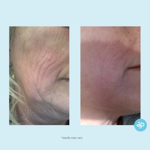 Perfect Image - Hydra-Repair Wrinkle Cream 60 g