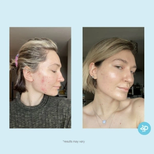 Perfect Image - Hydro-Glo 10%  Peel Pads (Level R)