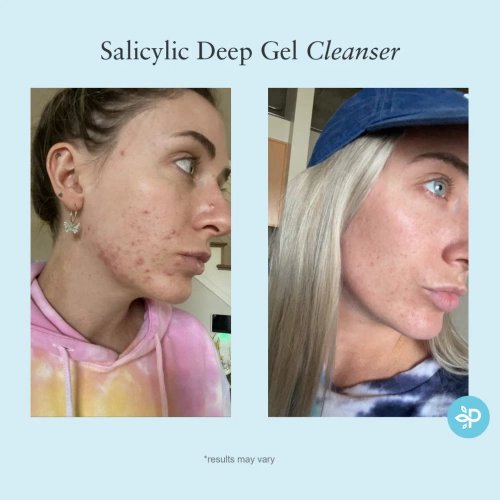 Salicylic Deep Gel Cleanser- żel do odtłuszczania 120 ml