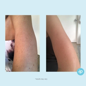 Hydro-Glo™ Peel- mieszanina kwasów w padach 30 sz.