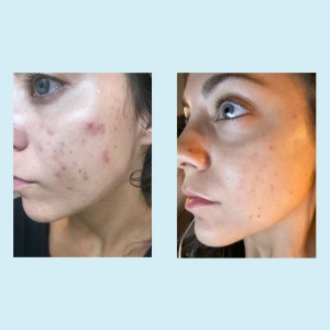 Perfect Image - Tri-Clarity™ Peel Pads 30 szt