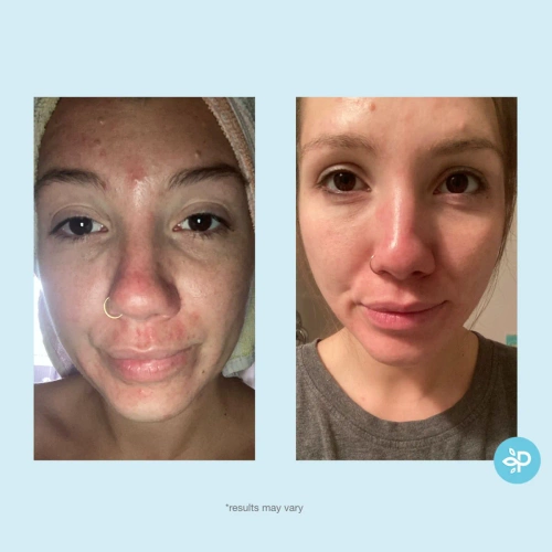 Glycolic 30% Gel Peel- kwas glikolowy 30% w żelu 30 ml