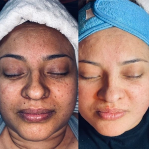 Glycolic 50% Gel Peel- kwas glikolowy 50% w żelu 30 ml