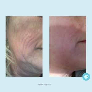 Perfect Image - Hydra-Repair Wrinkle Cream 60 g